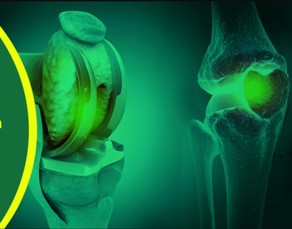 Pakistan Knee & Hip Society Arthroplasty Congress